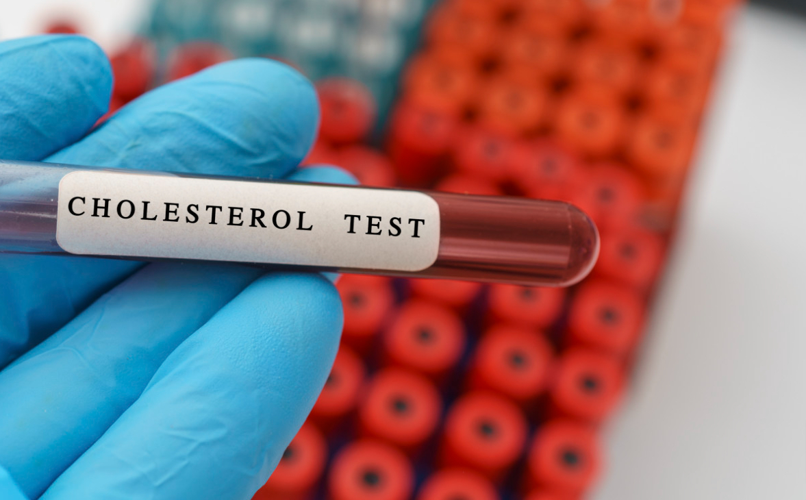 Borderline High Cholesterol: Understanding Its meaning and How to manage